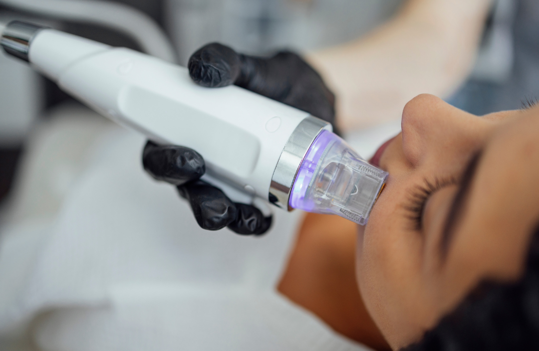 RF-Needling-Behandlung mit dem MiQuency-Handstück